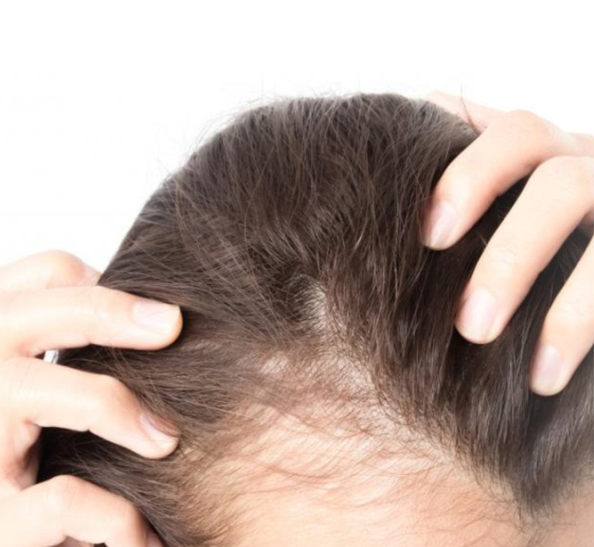 Hair Growth Plasma Therapy