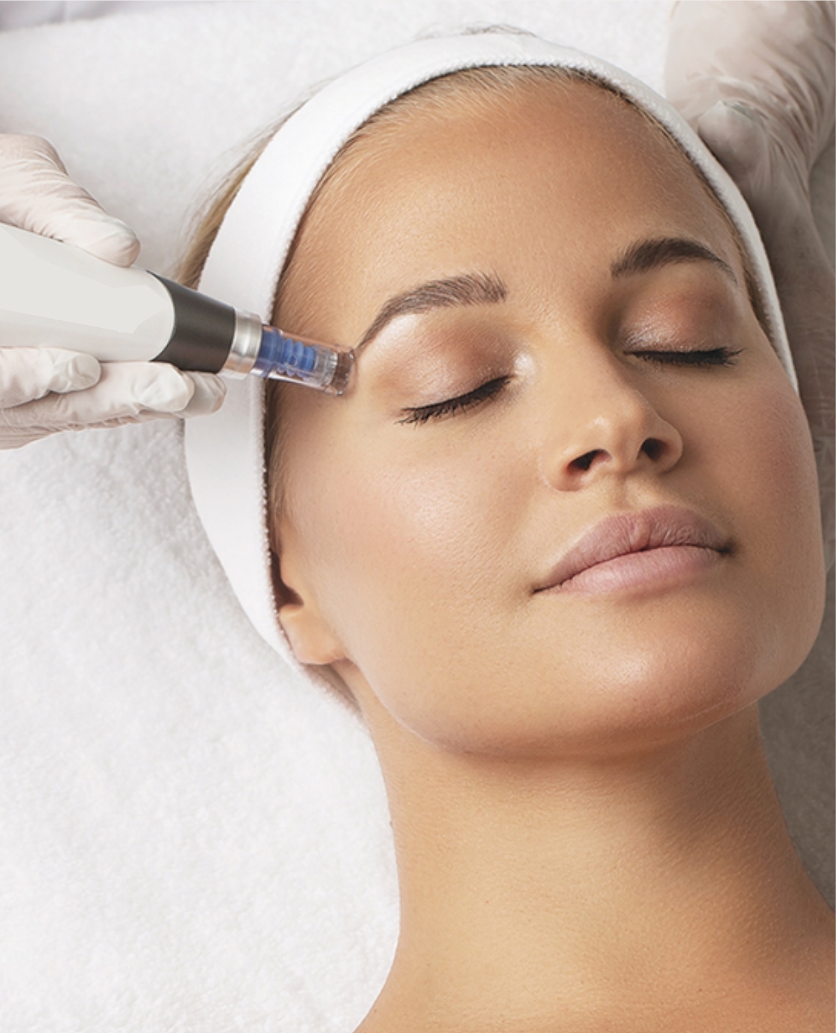 PRP Face Rejuvenation