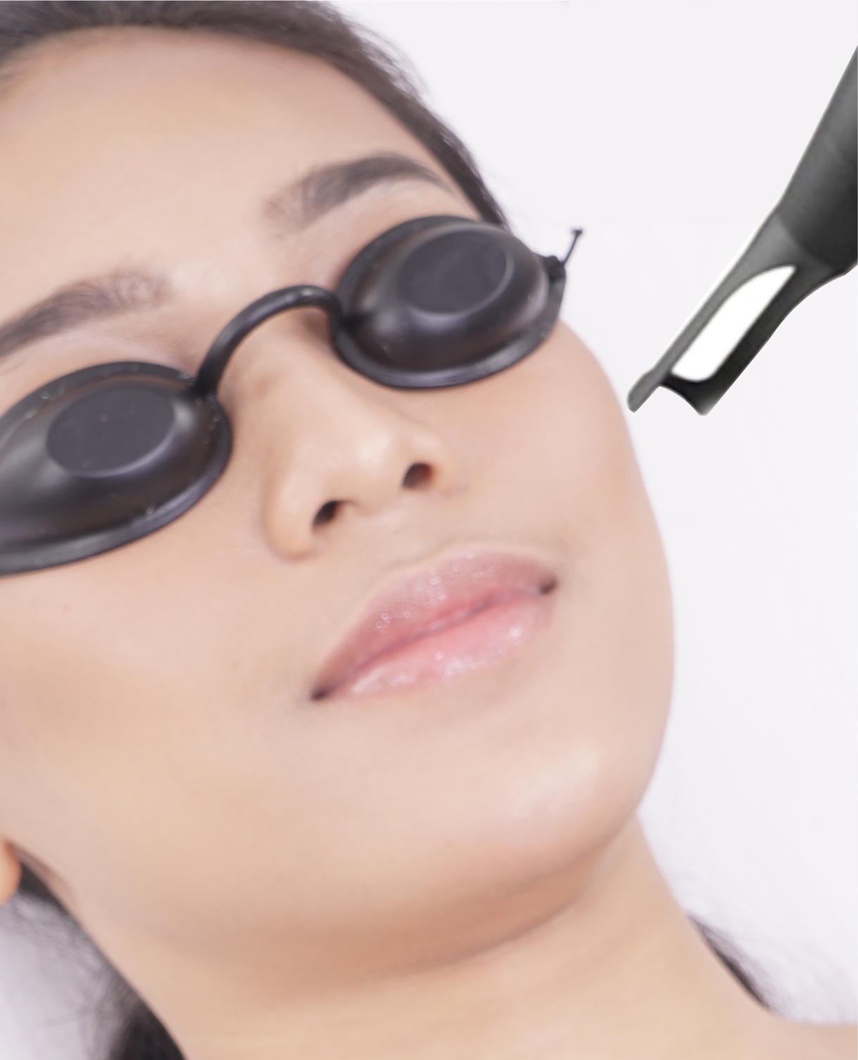 Laser Skin Rejuvenation