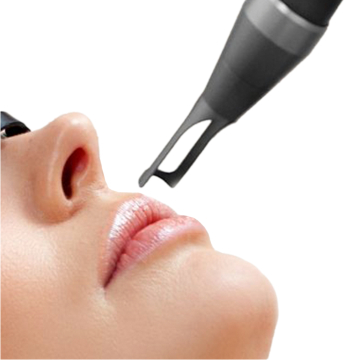 Laser Lip Rejuvenation